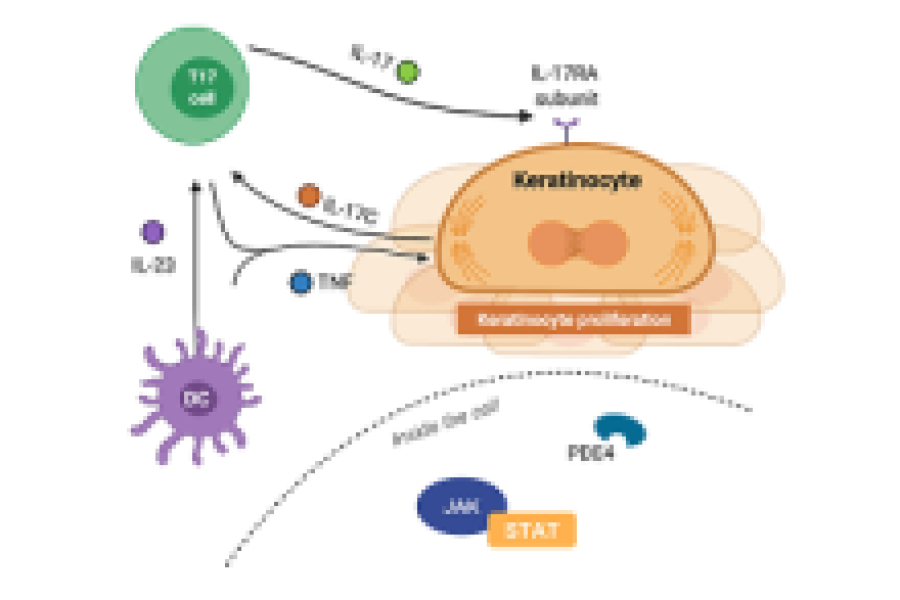 Causes & pathophysiology of psoriasis